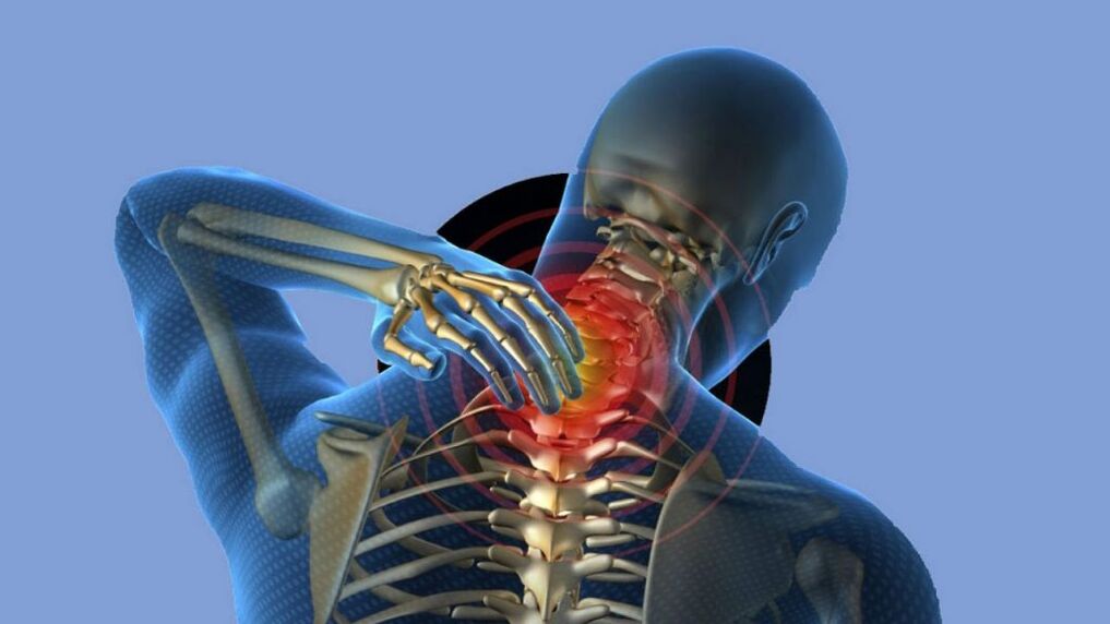 Osteocondrosis de la región cervical