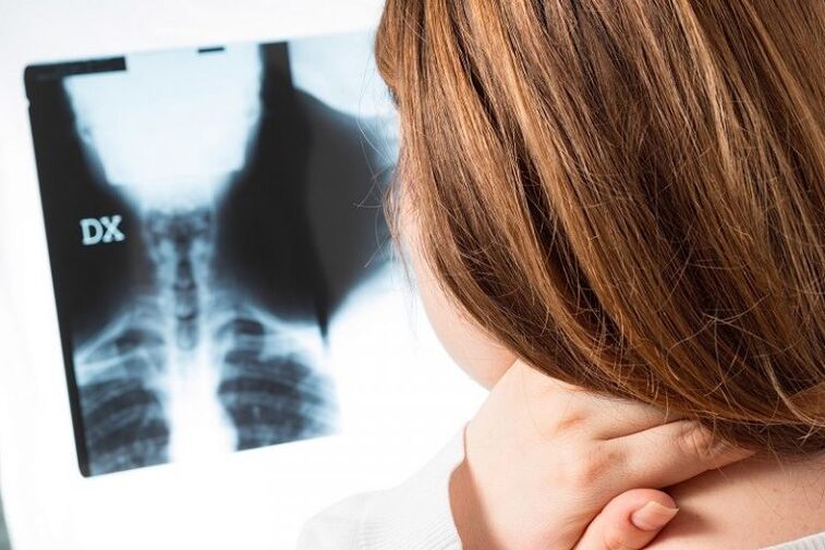 X -ray de la región cervical