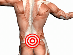 Síntomas y tratamiento de la osteocondrosis lumbar