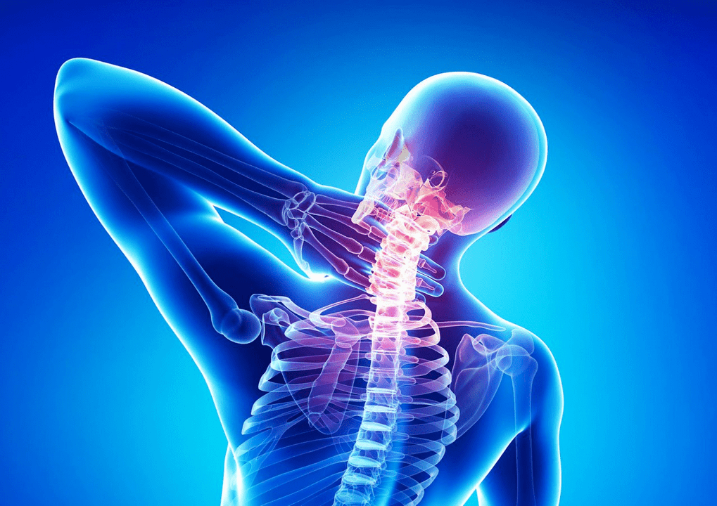 Osteocondrosis de la columna