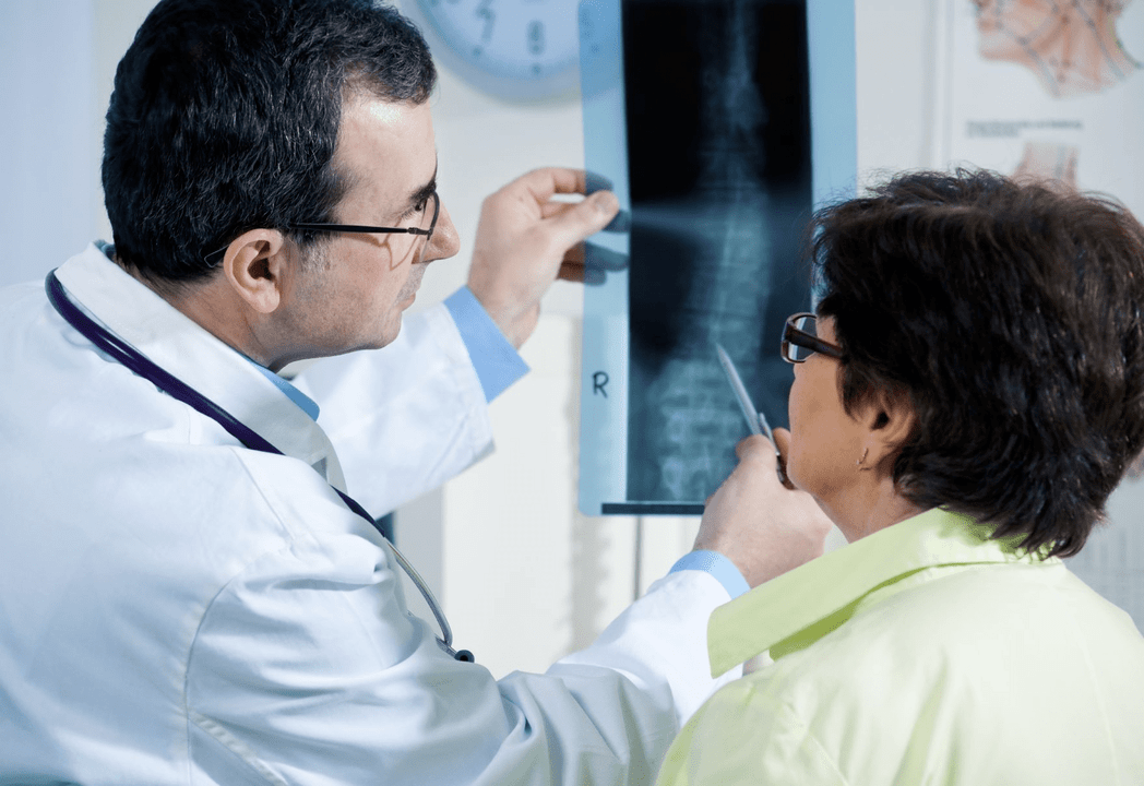 Un neurólogo diagnostica osteocondrosis mediante radiografía de la columna.